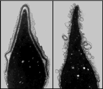 reaction_acrosomiale